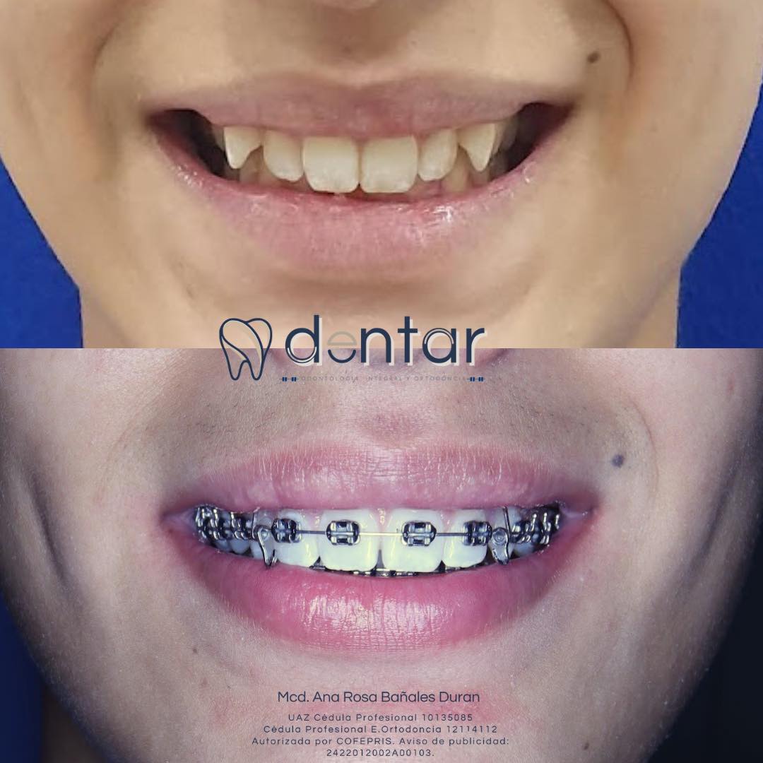 Resultado real — Dentar Odontología
